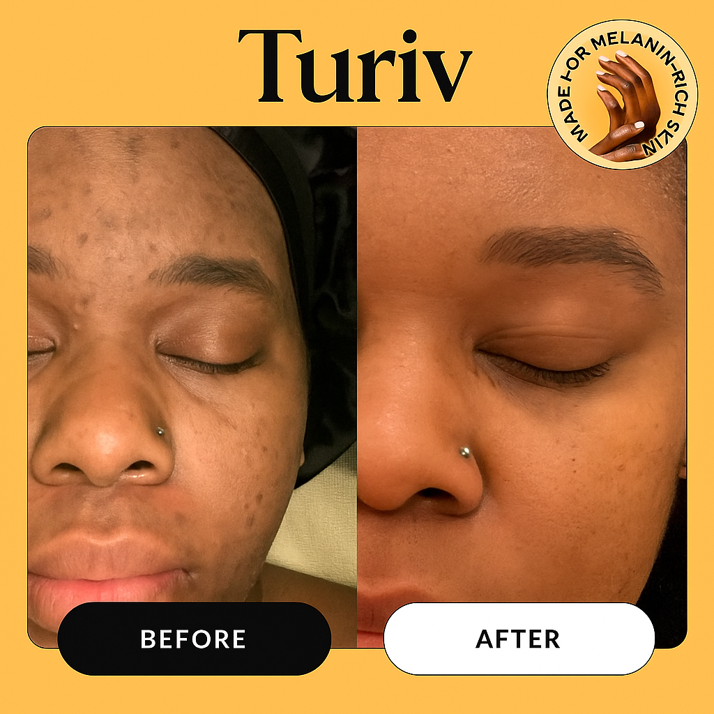 Turiv™ Turmeric & Kojic Acid Soap Bar
