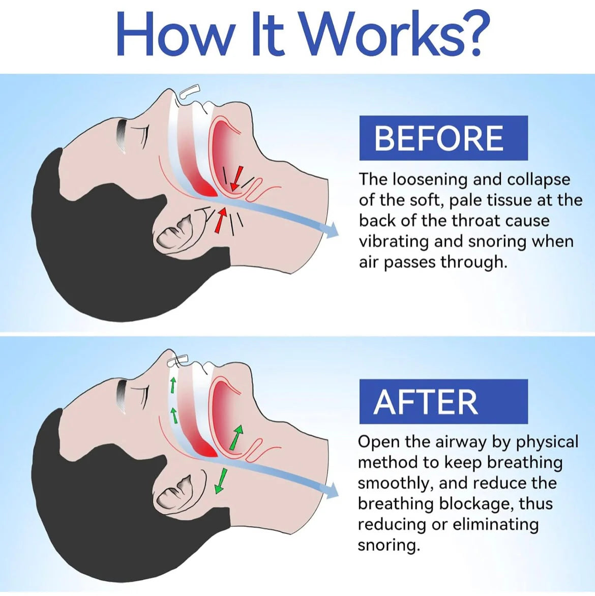 SnoreStoppers™ Nasal Airflow Clips